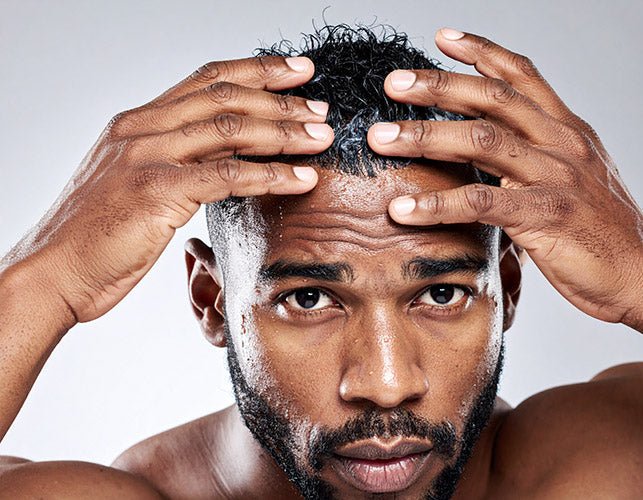 Fettige Kopfhaut – Tools & Utensilien für ein reines Gefühl - AFROSTYLE